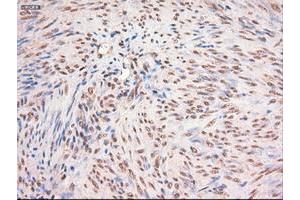 Image no. 1 for anti-Myc Proto-Oncogene protein (MYC) antibody (ABIN1497013) (c-MYC Antikörper)