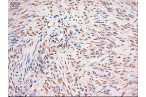 Image no. 1 for anti-Myc Proto-Oncogene protein (MYC) antibody (ABIN1497013)