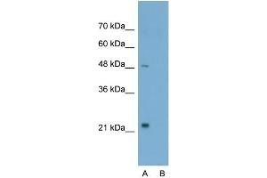 Host:  Rabbit  Target Name:  TSHR  Sample Type:  Jurkat  Lane A:  Primary Antibody  Lane B:  Primary Antibody + Blocking Peptide  Primary Antibody Concentration:  2. (TSH receptor Antikörper  (N-Term))