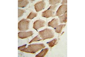 Immunohistochemistry (IHC) image for anti-Actin Related Protein 2/3 Complex, Subunit 1A, 41kDa (ARPC1A) antibody (ABIN3002659) (ARPC1A Antikörper)