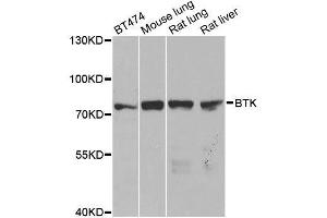 Western blot analysis of extracts of various cell lines, using BTK antibody. (BTK Antikörper  (AA 173-272))