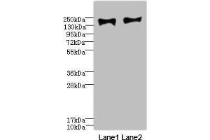 Western blot All lanes: MRC2 antibody at 3. (MRC2 Antikörper  (AA 120-300))