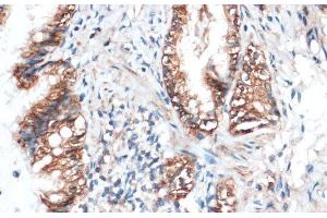 Immunohistochemistry of paraffin-embedded Rat lung using Aquaporin 4 Polyclonal Antibody at dilution of 1:100 (40x lens). (Aquaporin 4 Antikörper)