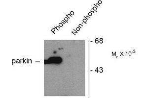 Image no. 1 for anti-Parkinson Protein 2, E3 Ubiquitin Protein Ligase (Parkin) (PARK2) (pSer101) antibody (ABIN372697) (Parkin Antikörper  (pSer101))