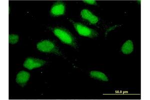 Immunofluorescence of monoclonal antibody to RNF113A on HeLa cell. (RNF113A Antikörper  (AA 1-343))