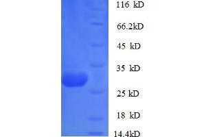SDS-PAGE (SDS) image for Cathepsin K (CTSK) (AA 115-329) protein (His tag) (ABIN5709367) (Cathepsin K Protein (CTSK) (AA 115-329) (His tag))