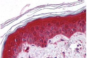 Human Skin (formalin-fixed, paraffin-embedded) stained with PYCARD antibody ABIN213971 at 5 ug/ml followed by biotinylated goat anti-rabbit IgG secondary antibody ABIN481713, alkaline phosphatase-streptavidin and chromogen. (PYCARD Antikörper  (AA 182-195))