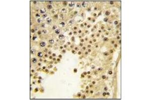 Image no. 2 for anti-Lysine (K)-Specific Demethylase 2A (KDM2A) antibody (ABIN356581) (KDM2A Antikörper)
