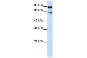 WB Suggested Anti-PPWD1 Antibody Titration: 0. (PPWD1 Antikörper  (Middle Region))