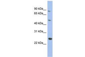 Image no. 1 for anti-Matrilin 3 (MATN3) (AA 215-264) antibody (ABIN6744056) (Matrilin 3 Antikörper  (AA 215-264))
