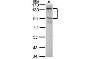 WB Image CIZ1 antibody [N2C1], Internal detects CIZ1 protein by Western blot analysis.