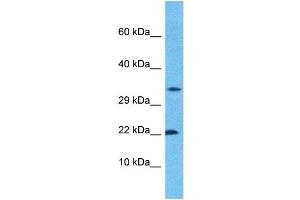 Host:  Rabbit  Target Name:  CROC4  Sample Type:  ACHN Whole Cell lysates  Antibody Dilution:  1. (C1orf61 Antikörper  (N-Term))