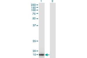 Western Blot analysis of SNX3 expression in transfected 293T cell line by SNX3 monoclonal antibody (M05), clone 3D7.