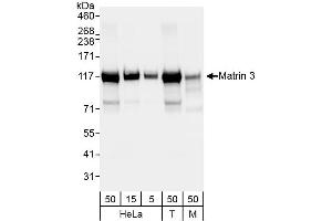 Western Blotting (WB) image for anti-Matrin 3 (MATR3) (C-Term) antibody (ABIN7455225)
