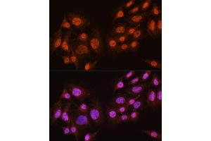 Immunofluorescence analysis of C6 cells using // antibody (ABIN7265520) at dilution of 1:100. (AKT 1/2/3 Antikörper)