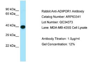 Western Blotting (WB) image for anti-Adiponectin Receptor 1 (ADIPOR1) (C-Term) antibody (ABIN2789457)