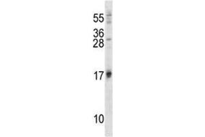 ISG15 antibody western blot analysis in 293 lysate (ISG15 Antikörper  (AA 31-61))