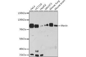 Western blot analysis of extracts of various cell lines, using Menin Rabbit mAb (ABIN7268697) at 1:1000 dilution. (Menin Antikörper)