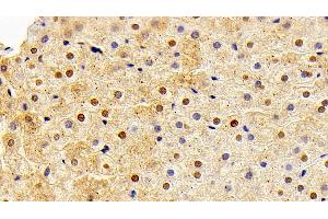Detection of FGF2 in Rabbit Liver Tissue using Polyclonal Antibody to Fibroblast Growth Factor 2, Basic (FGF2) (FGF2 Antikörper  (AA 26-153))
