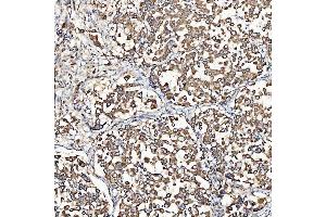 IHC analysis of SH2D4A using anti-SH2D4A antibody (ABIN7601695).