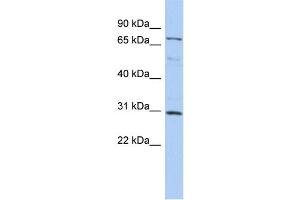 WB Suggested Anti-DMTF1 Antibody Titration:  0. (DMP1 Antikörper  (N-Term))