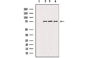 Western blot analysis of extracts from various samples, using RNF156 antibody. (Mahogunin RING Finger Protein 1 Antikörper  (Internal Region))