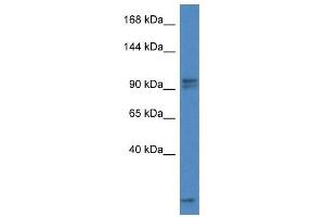 Western Blot showing Aak1 antibody used at a concentration of 1. (AAK1 Antikörper  (C-Term))