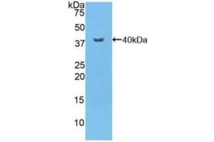 Detection of Recombinant NFkB, Mouse using Polyclonal Antibody to Nuclear Factor Kappa B (NFkB) (NFkB Antikörper  (AA 40-365))