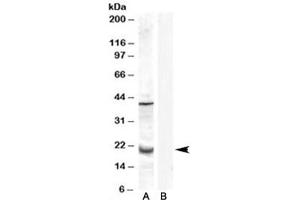 Western blot testing of human prostate lysate with GPX7 antibody at 0. (Glutathione Peroxidase 7 Antikörper)