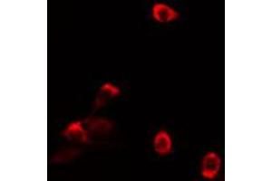 ABIN6274125 staining HT29 cells by IF/ICC. (TAF5L Antikörper  (Internal Region))