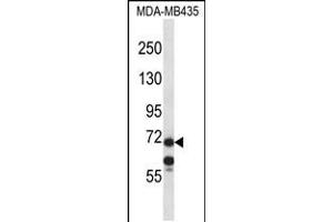 Western blot analysis in MDA-MB435 cell line lysates (35ug/lane). (MID1 Antikörper  (C-Term))