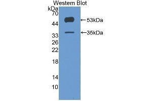 Western Blotting (WB) image for anti-Angiopoietin-Like 4 (ANGPTL4) (AA 182-388) antibody (ABIN3207381) (ANGPTL4 Antikörper  (AA 182-388))