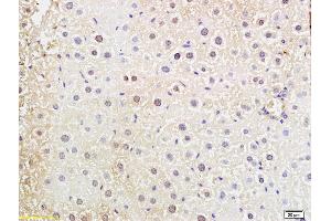 Formalin-fixed and paraffin embedded mouse liver labeled with Anti-DNTT Polyclonal Antibody, Unconjugated (ABIN681973) at 1:200 followed by conjugation to the secondary antibody and DAB staining (TdT Antikörper  (AA 351-450))