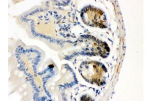 Anti- Cdk4 Picoband antibody, IHC(P) IHC(P): Mouse Intestine Tissue