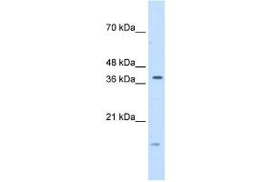 WB Suggested Anti-TFB2M Antibody Titration:  5. (TFB2M Antikörper  (C-Term))