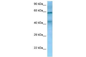 WB Suggested Anti-TIMD4 Antibody Titration: 1. (TIMD4 Antikörper  (N-Term))