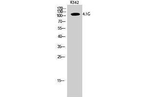 Western Blotting (WB) image for anti-erythrocyte Membrane Protein Band 4.1-Like 2 (EPB41L2) (Internal Region) antibody (ABIN3183088) (EPB41L2 Antikörper  (Internal Region))