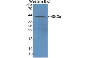 Detection of Recombinant NOX5, Human using Polyclonal Antibody to Nicotinamide Adenine Dinucleotide Phosphate Oxidase 5 (NOX5) (NOX5 Antikörper  (AA 456-765))