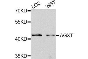 Western blot analysis of extracts of LO2 and 293T cells, using AGXT antibody. (AGXT Antikörper)