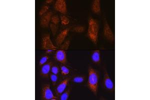 Immunofluorescence analysis of U-2 OS cells using PLK1 Rabbit pAb (ABIN3023351, ABIN3023352, ABIN3023353 and ABIN6219645) at dilution of 1:100 (40x lens). (PLK1 Antikörper  (AA 304-603))