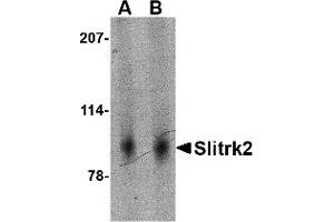 Western Blotting (WB) image for anti-SLIT and NTRK-Like Family, Member 2 (SLITRK2) (Middle Region) antibody (ABIN1031099) (SLITRK2 Antikörper  (Middle Region))