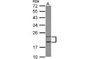 WB Image Sample (30 ug of whole cell lysate) A: HeLa 12% SDS PAGE antibody diluted at 1:1000 (PYCARD Antikörper)