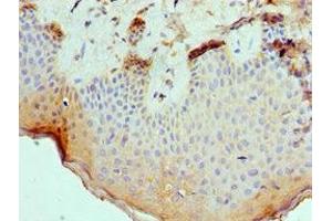 Immunohistochemistry of paraffin-embedded human skin tissue using ABIN7168694 at dilution of 1:100 (SLURP1 Antikörper  (AA 1-103))