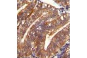 Formalin fixed and paraffin embedded human uterus tissue reacted with Periostin Antibody (C-term) followed by peroxidase conjugation of the secondary antibody and DAB staining. (Periostin Antikörper  (C-Term))