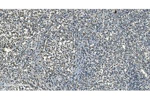IHC analysis of LSM8 using anti-LSM8 antibody (ABIN7599579). (NAA38 Antikörper  (AA 1-96))