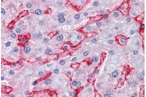 Human Liver (formalin-fixed, paraffin-embedded) stained with AOC3 antibody ABIN351485 at 3. (AOC3 Antikörper  (AA 712-724))