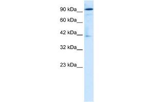 WB Suggested Anti-ZA20D1 Antibody Titration:  1. (OTUD7B Antikörper  (Middle Region))