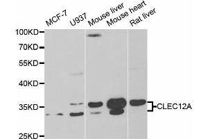 Western blot analysis of extracts of various cell lines, using CLEC12A antibody (ABIN5973681) at 1/1000 dilution. (CLEC12A Antikörper)