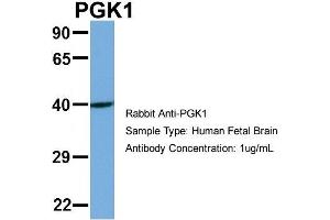 Host: Rabbit Target Name: PGK1 Sample Type: Human Fetal Brain Antibody Dilution: 1. (PGK1 Antikörper  (N-Term))