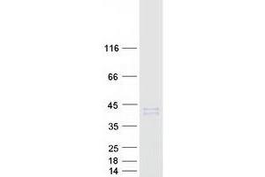 Western Blotting (WB) image for Hydroxysteroid (11-Beta) Dehydrogenase 1 (HSD11B1) (Transcript Variant 2) protein (Myc-DYKDDDDK Tag) (ABIN2715549)